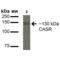 Calcium Sensing Receptor antibody, SPC-713D-A565, StressMarq, Western Blot image 