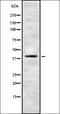 KITH_HHV1C antibody, orb337574, Biorbyt, Western Blot image 