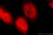 Pyruvate Kinase M1/2 antibody, 15821-1-AP, Proteintech Group, Immunofluorescence image 