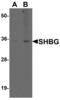 Sex Hormone Binding Globulin antibody, MBS153715, MyBioSource, Western Blot image 