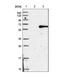 Chordin Like 1 antibody, NBP1-84486, Novus Biologicals, Western Blot image 