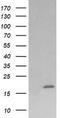 Cancer/Testis Antigen 1B antibody, CF505949, Origene, Western Blot image 
