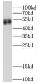 Cardiolipin Synthase 1 antibody, FNab01982, FineTest, Western Blot image 