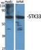 Serine/Threonine Kinase 33 antibody, A07375, Boster Biological Technology, Western Blot image 