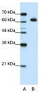 DIS3 Like 3'-5' Exoribonuclease 2 antibody, TA344005, Origene, Western Blot image 