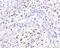 GGCX antibody, A02643-1, Boster Biological Technology, Immunohistochemistry paraffin image 