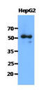 Syntrophin Alpha 1 antibody, AM50039PU-N, Origene, Western Blot image 