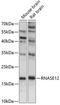 Ribonuclease A Family Member 12 (Inactive) antibody, 15-627, ProSci, Western Blot image 