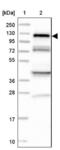 Huntingtin Interacting Protein 1 Related antibody, NBP2-38390, Novus Biologicals, Western Blot image 