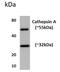 Cathepsin A antibody, GTX52576, GeneTex, Western Blot image 