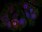 Fatty Acid Binding Protein 5 antibody, orb27768, Biorbyt, Immunocytochemistry image 