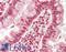 Folliculin antibody, LS-B15471, Lifespan Biosciences, Immunohistochemistry paraffin image 