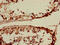 Solute Carrier Family 15 Member 3 antibody, CSB-PA815578LA01HU, Cusabio, Immunohistochemistry paraffin image 