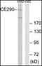 Centrosomal Protein 290 antibody, orb178925, Biorbyt, Western Blot image 