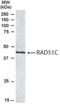 DNA repair protein RAD51 homolog 3 antibody, NB100-1127, Novus Biologicals, Immunohistochemistry paraffin image 