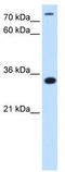Phosphatidate cytidylyltransferase, mitochondrial antibody, TA342495, Origene, Western Blot image 