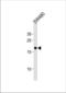 60S ribosomal protein L29 antibody, TA325159, Origene, Western Blot image 
