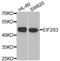 Eukaryotic Translation Initiation Factor 2 Subunit Gamma antibody, A6581, ABclonal Technology, Western Blot image 