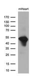 Protein Phosphatase 1 Regulatory Subunit 36 antibody, M17066, Boster Biological Technology, Western Blot image 