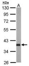 Aldo-Keto Reductase Family 1 Member D1 antibody, GTX117738, GeneTex, Western Blot image 