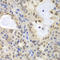 Minichromosome Maintenance Complex Component 3 antibody, LS-C331230, Lifespan Biosciences, Immunohistochemistry paraffin image 