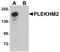 Pleckstrin Homology And RUN Domain Containing M2 antibody, PA5-20850, Invitrogen Antibodies, Western Blot image 