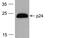 HIV-1 Gag polyprotein antibody, PM-6585-HRP, ProSci, Western Blot image 