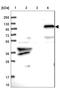 Zinc Finger Protein 438 antibody, NBP1-88797, Novus Biologicals, Western Blot image 