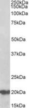 DnaJ Heat Shock Protein Family (Hsp40) Member C5 antibody, MBS422924, MyBioSource, Western Blot image 