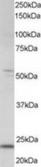 MAX Dimerization Protein 4 antibody, TA302831, Origene, Western Blot image 