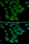 Calcium/Calmodulin Dependent Protein Kinase I antibody, orb247743, Biorbyt, Immunofluorescence image 