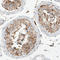 Succinate dehydrogenase [ubiquinone] iron-sulfur subunit, mitochondrial antibody, AMAb90705, Atlas Antibodies, Immunohistochemistry frozen image 