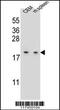 LSM7 Homolog, U6 Small Nuclear RNA And MRNA Degradation Associated antibody, 55-981, ProSci, Western Blot image 