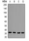 Capping Actin Protein Of Muscle Z-Line Subunit Beta antibody, abx142049, Abbexa, Western Blot image 