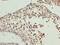 Cytochrome B5 Reductase 2 antibody, CSB-PA738178LA01HU, Cusabio, Immunohistochemistry frozen image 
