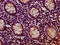 RIO Kinase 2 antibody, LS-C681212, Lifespan Biosciences, Immunohistochemistry paraffin image 