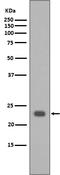 BCL2 Antagonist/Killer 1 antibody, M01163, Boster Biological Technology, Western Blot image 