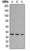 Cytochrome P450 Family 27 Subfamily C Member 1 antibody, orb234818, Biorbyt, Western Blot image 