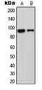 Disintegrin and metalloproteinase domain-containing protein 23 antibody, GTX54917, GeneTex, Western Blot image 