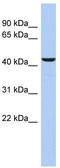 DNA Fragmentation Factor Subunit Beta antibody, TA340051, Origene, Western Blot image 