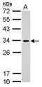 Mitochondrial Ribosomal Protein S18B antibody, GTX118100, GeneTex, Western Blot image 