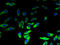 Lysophospholipase 2 antibody, LS-C211831, Lifespan Biosciences, Immunofluorescence image 
