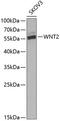 Wnt Family Member 2 antibody, A03226-1, Boster Biological Technology, Western Blot image 