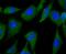 HECT Domain E3 Ubiquitin Protein Ligase 4 antibody, NBP2-75411, Novus Biologicals, Immunocytochemistry image 