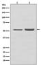 SNEV antibody, M02434, Boster Biological Technology, Western Blot image 