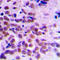 Cyclin Dependent Kinase 1 antibody, LS-C351970, Lifespan Biosciences, Immunohistochemistry paraffin image 