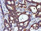 LIM Domain Kinase 1 antibody, LS-C173012, Lifespan Biosciences, Immunohistochemistry frozen image 