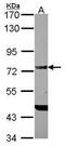DEAD-Box Helicase 4 antibody, PA5-30749, Invitrogen Antibodies, Western Blot image 