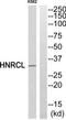Heterogeneous Nuclear Ribonucleoprotein C Like 1 antibody, TA316366, Origene, Western Blot image 