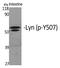 LYN Proto-Oncogene, Src Family Tyrosine Kinase antibody, P01424, Boster Biological Technology, Western Blot image 